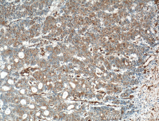 ARNTL Antibody in Immunohistochemistry (Paraffin) (IHC (P))