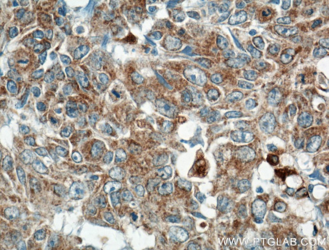 ARNTL Antibody in Immunohistochemistry (Paraffin) (IHC (P))