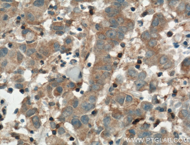 ARNTL Antibody in Immunohistochemistry (Paraffin) (IHC (P))