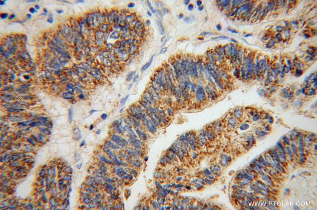 ABCG4 Antibody in Immunohistochemistry (Paraffin) (IHC (P))