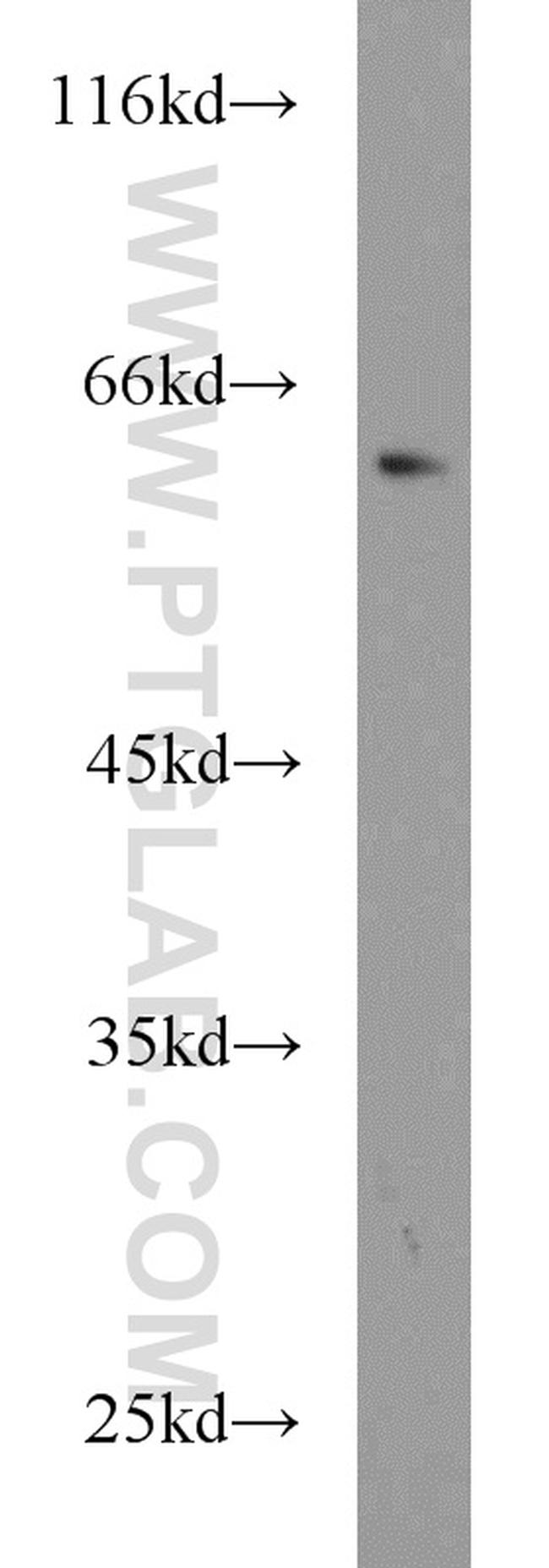 ABCG4 Antibody in Western Blot (WB)