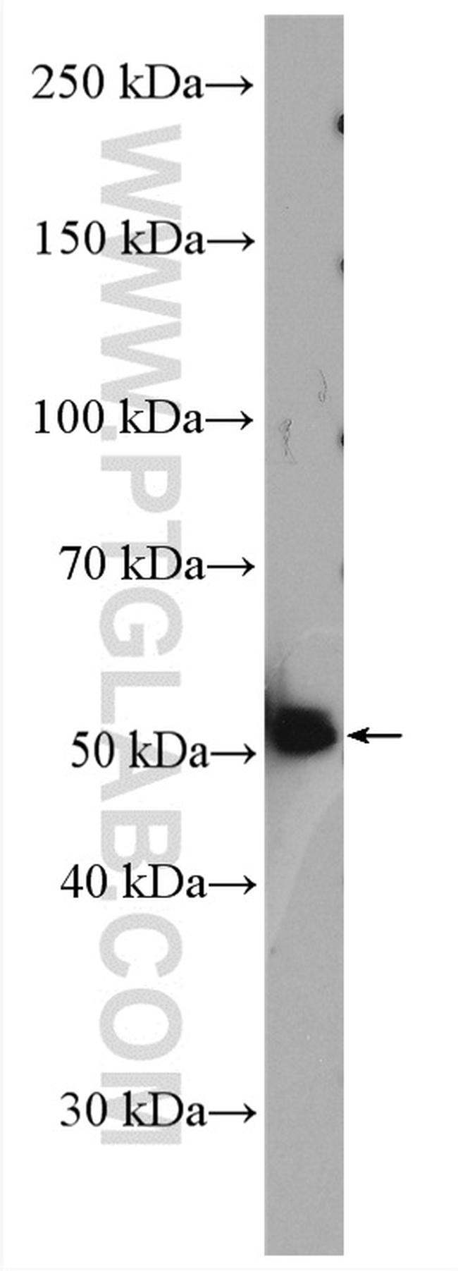 VPS4A Antibody in Western Blot (WB)