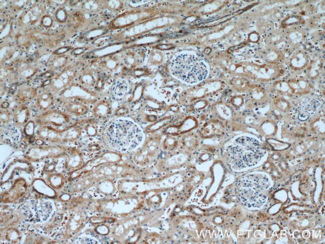 SRX1 Antibody in Immunohistochemistry (Paraffin) (IHC (P))