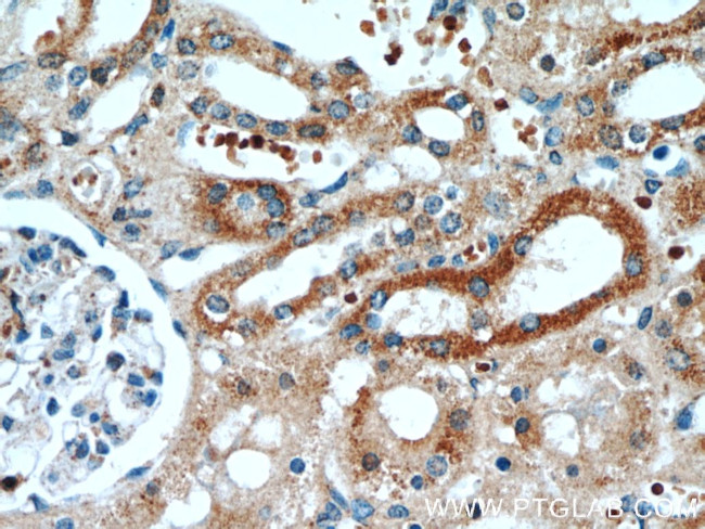 SRX1 Antibody in Immunohistochemistry (Paraffin) (IHC (P))