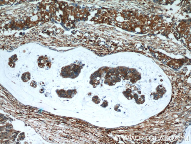 SRX1 Antibody in Immunohistochemistry (Paraffin) (IHC (P))