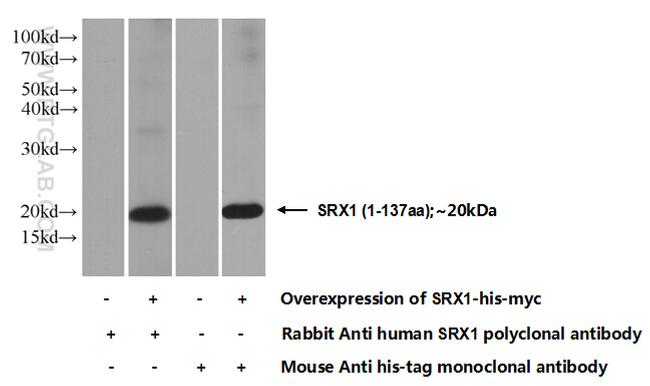 SRX1 Antibody in Western Blot (WB)