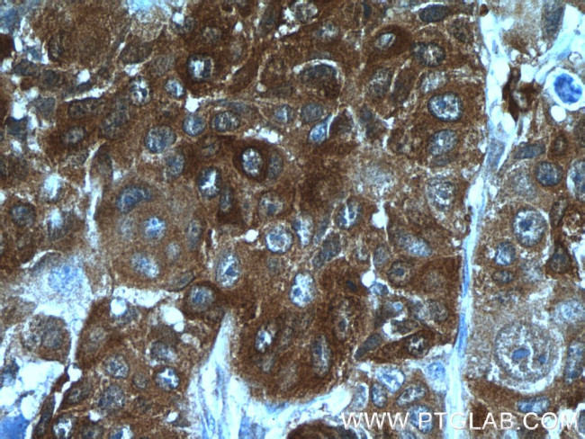 SRX1 Antibody in Immunohistochemistry (Paraffin) (IHC (P))