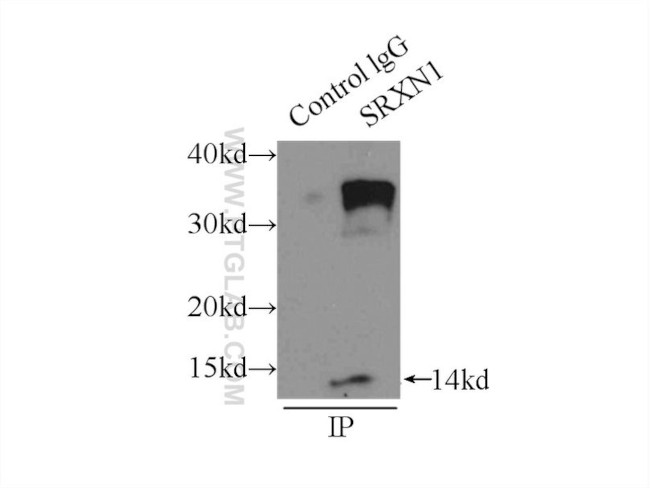SRX1 Antibody in Immunoprecipitation (IP)