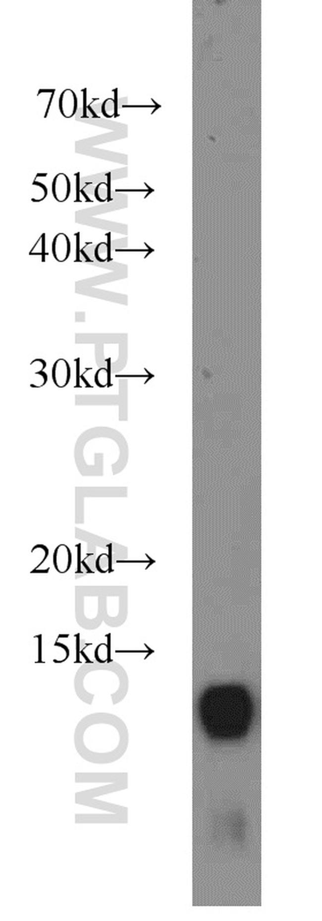 SRX1 Antibody in Western Blot (WB)