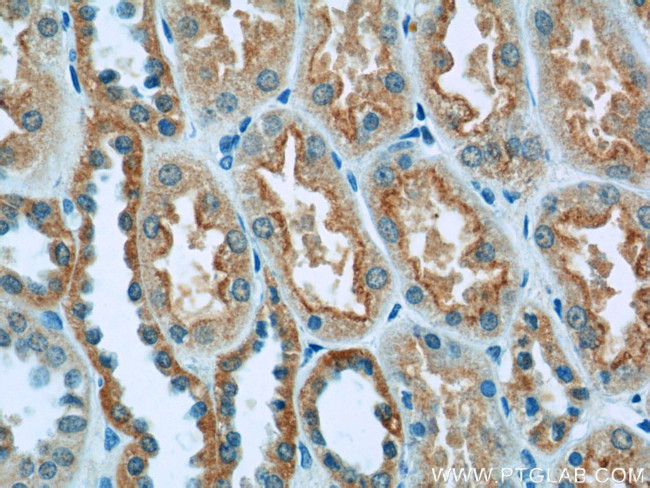 GFM1 Antibody in Immunohistochemistry (Paraffin) (IHC (P))