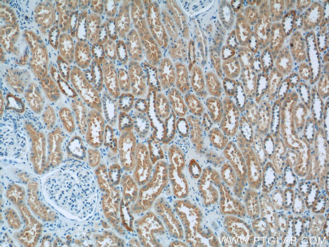 GFM1 Antibody in Immunohistochemistry (Paraffin) (IHC (P))