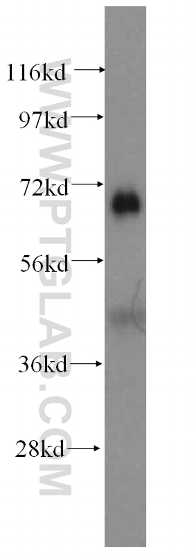 GFM1 Antibody in Western Blot (WB)