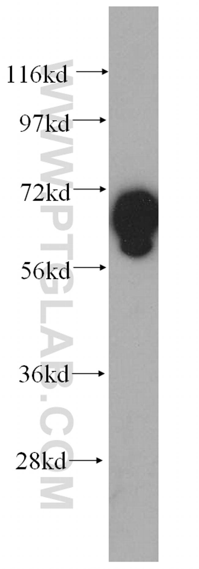 GFM1 Antibody in Western Blot (WB)