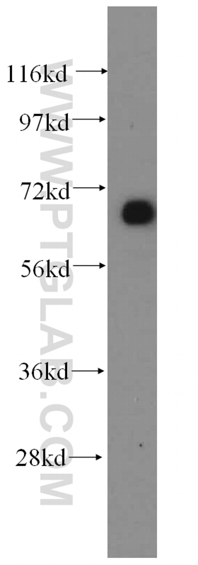 GFM1 Antibody in Western Blot (WB)