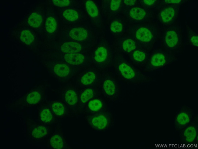 FBXO18 Antibody in Immunocytochemistry (ICC/IF)