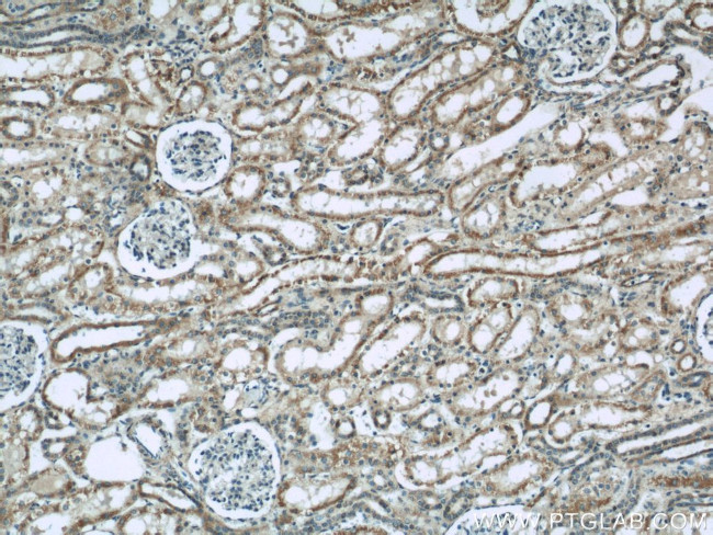 CNOT1 Antibody in Immunohistochemistry (Paraffin) (IHC (P))