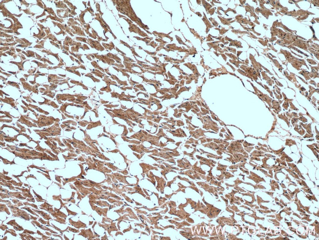 CNOT1 Antibody in Immunohistochemistry (Paraffin) (IHC (P))