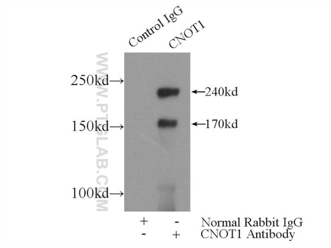 CNOT1 Antibody in Immunoprecipitation (IP)