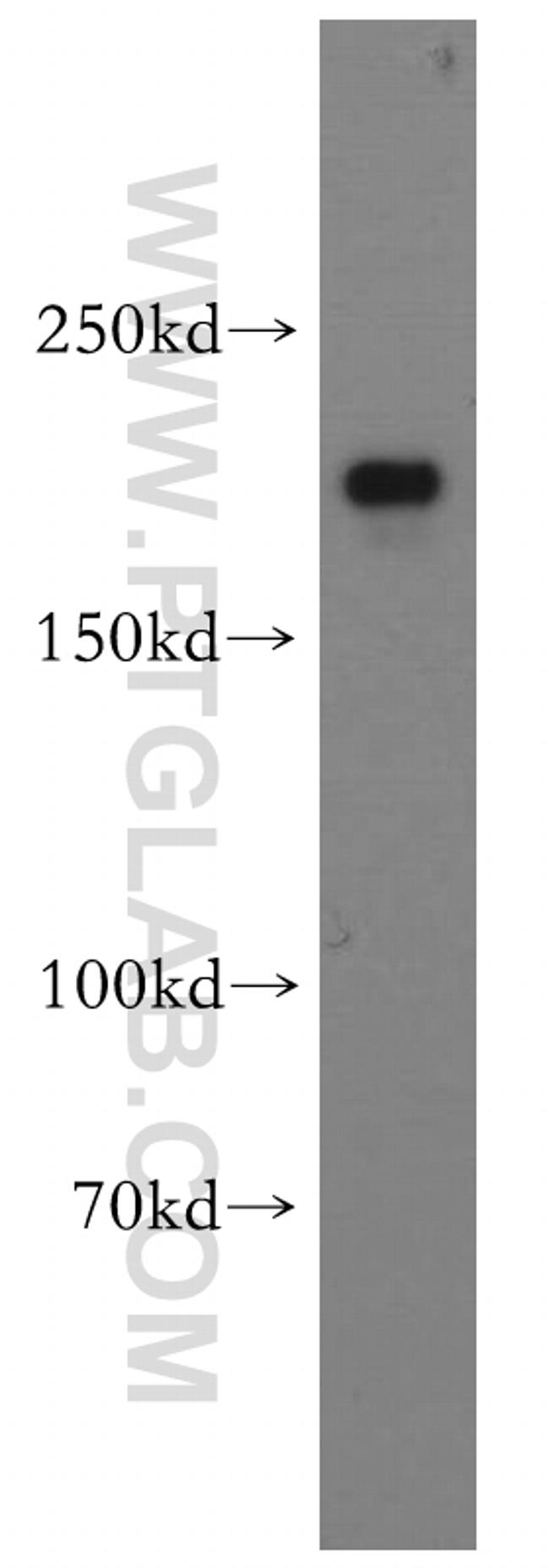 CNOT1 Antibody in Western Blot (WB)