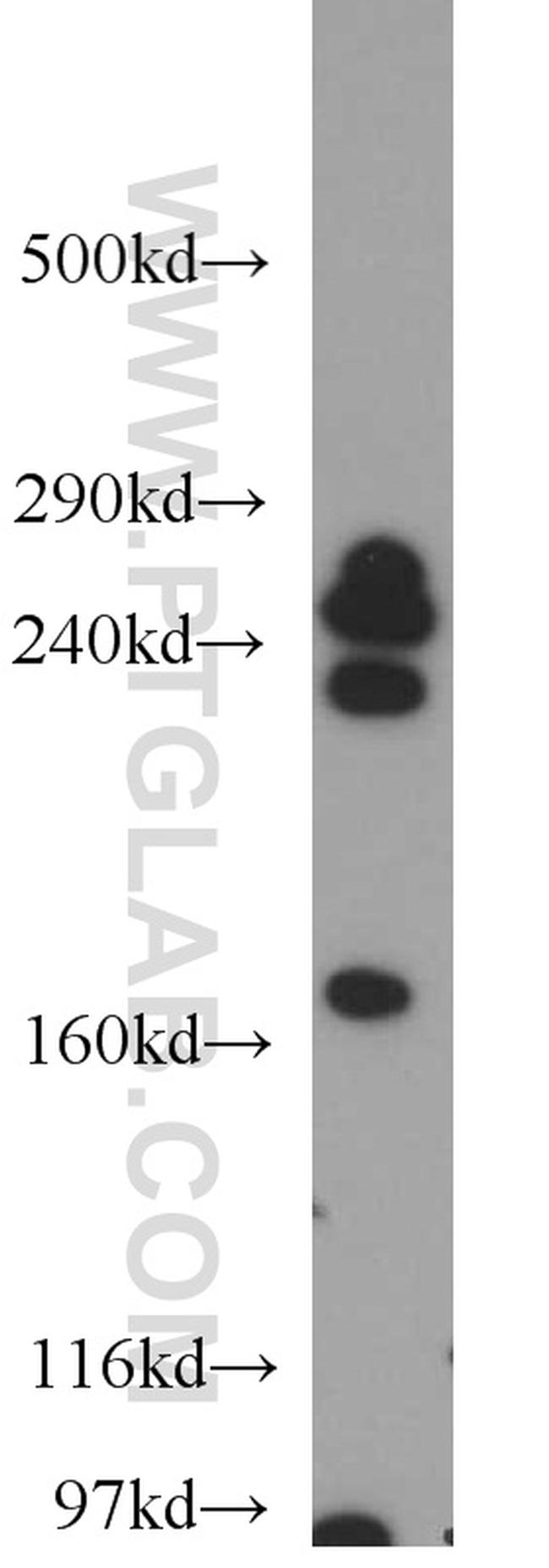 CNOT1 Antibody in Western Blot (WB)