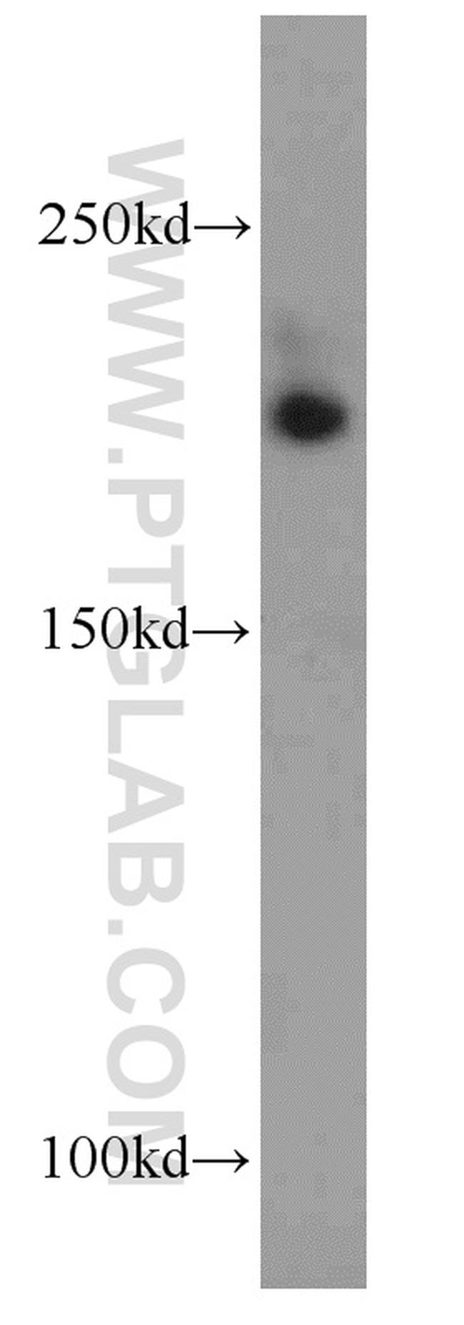 CNOT1 Antibody in Western Blot (WB)