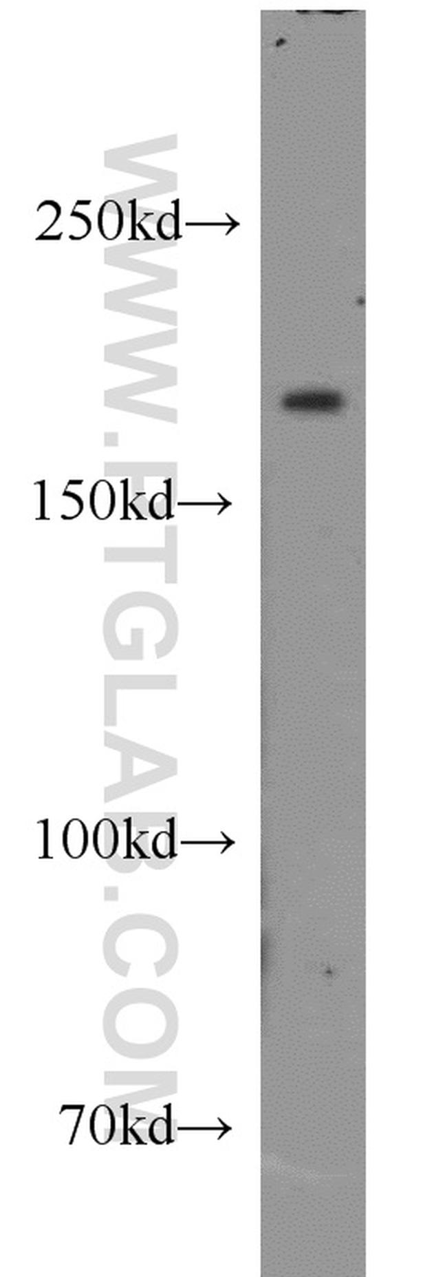 CNOT1 Antibody in Western Blot (WB)