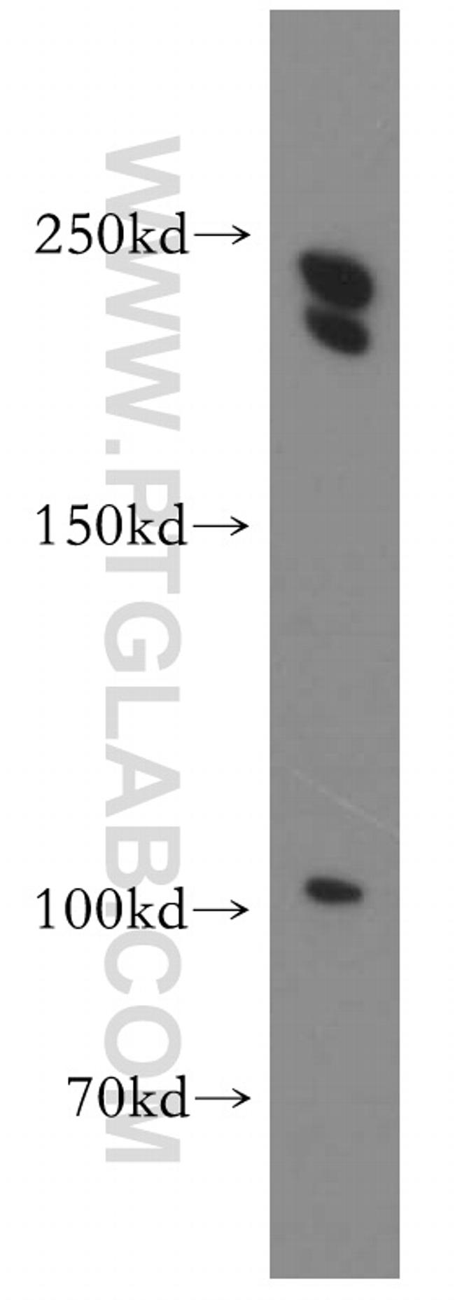 CNOT1 Antibody in Western Blot (WB)