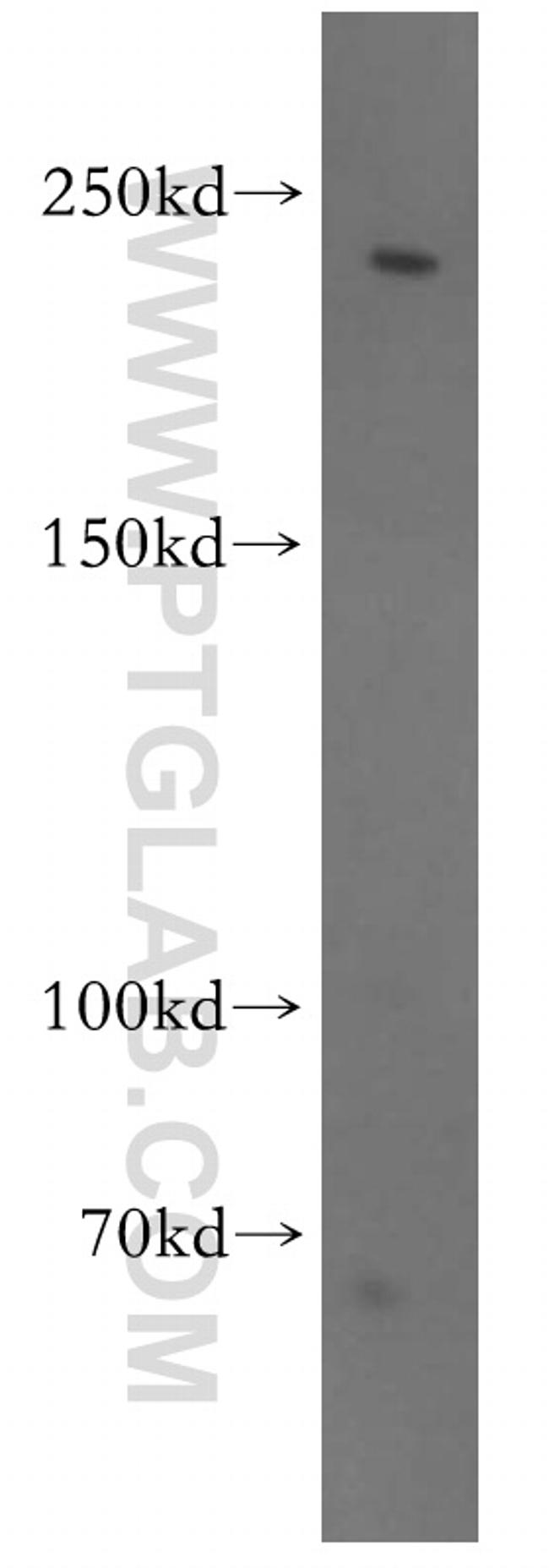 CNOT1 Antibody in Western Blot (WB)