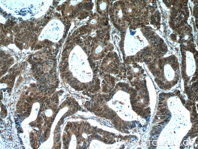 ZWILCH Antibody in Immunohistochemistry (Paraffin) (IHC (P))