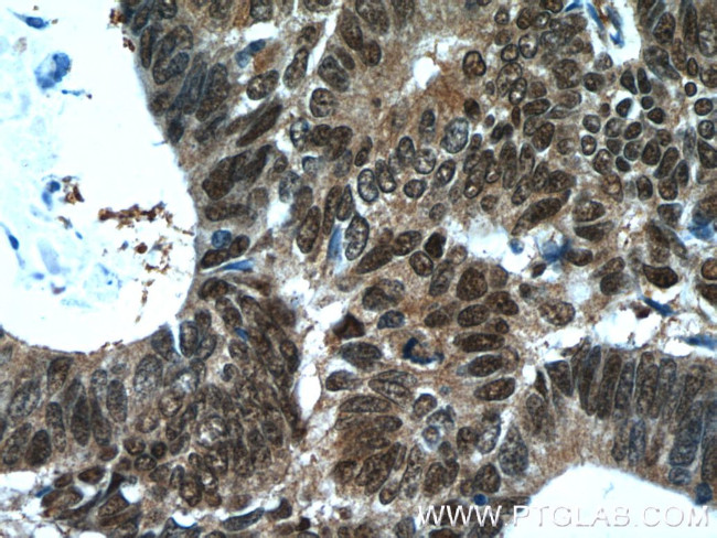 ZWILCH Antibody in Immunohistochemistry (Paraffin) (IHC (P))