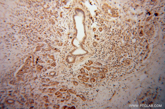 ARHGDIG Antibody in Immunohistochemistry (Paraffin) (IHC (P))