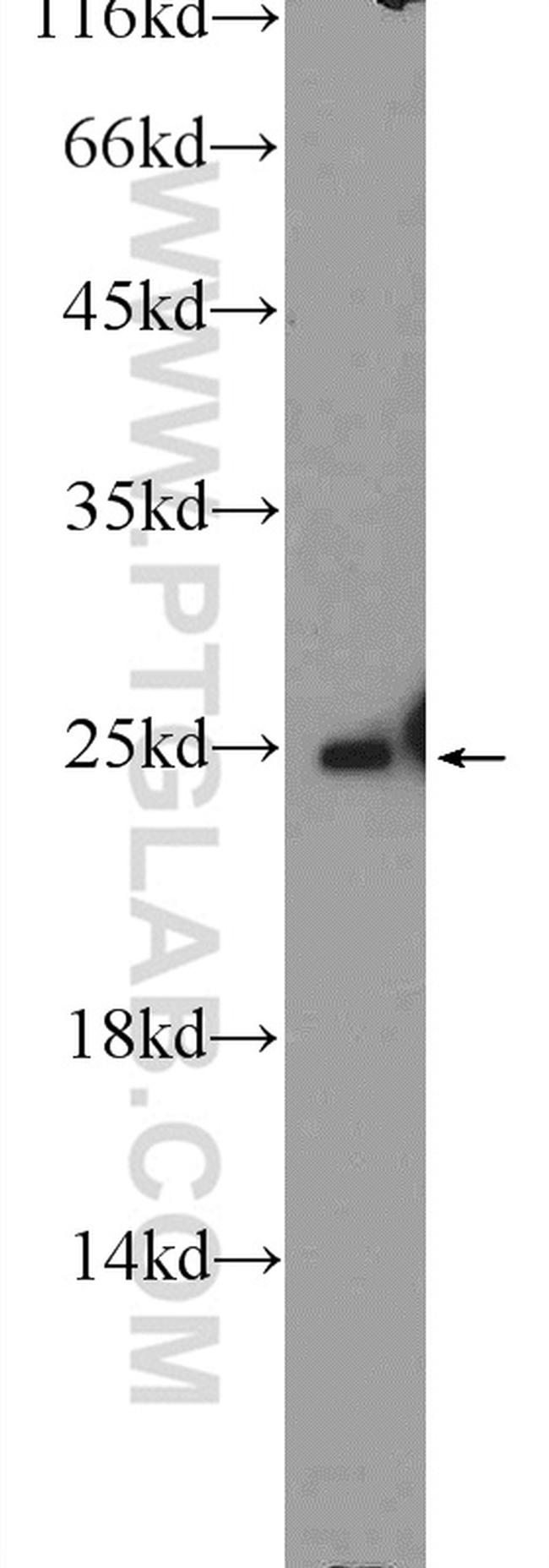 ARHGDIG Antibody in Western Blot (WB)