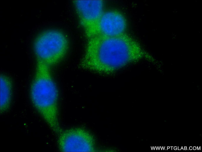 RAB26 Antibody in Immunocytochemistry (ICC/IF)