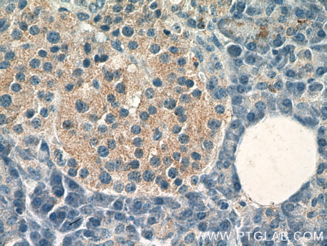 RAB26 Antibody in Immunohistochemistry (Paraffin) (IHC (P))