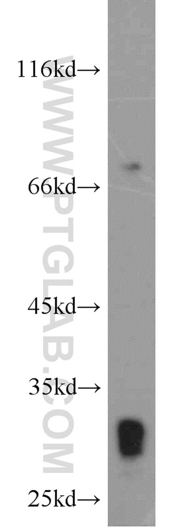 RAB26 Antibody in Western Blot (WB)