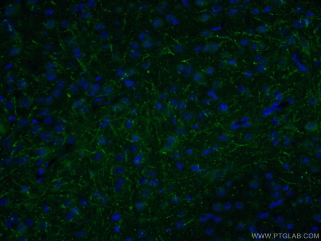 LRRTM1 Antibody in Immunohistochemistry (PFA fixed) (IHC (PFA))