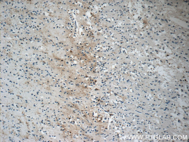 LRRTM1 Antibody in Immunohistochemistry (Paraffin) (IHC (P))