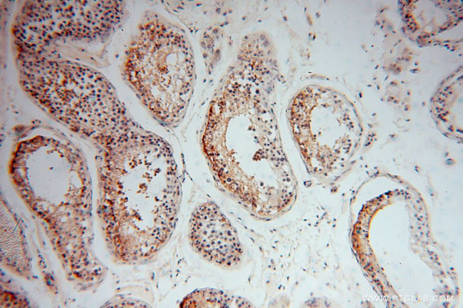 LRRTM1 Antibody in Immunohistochemistry (Paraffin) (IHC (P))