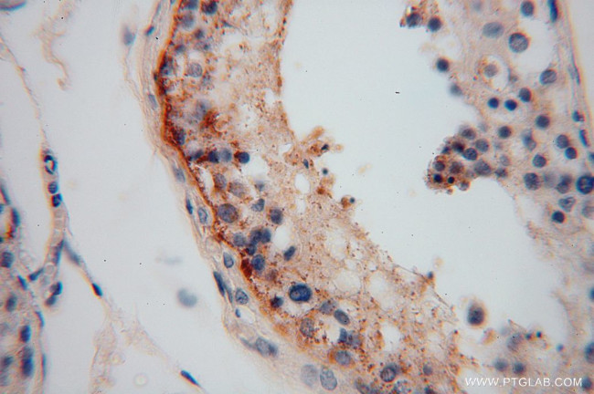 LRRTM1 Antibody in Immunohistochemistry (Paraffin) (IHC (P))