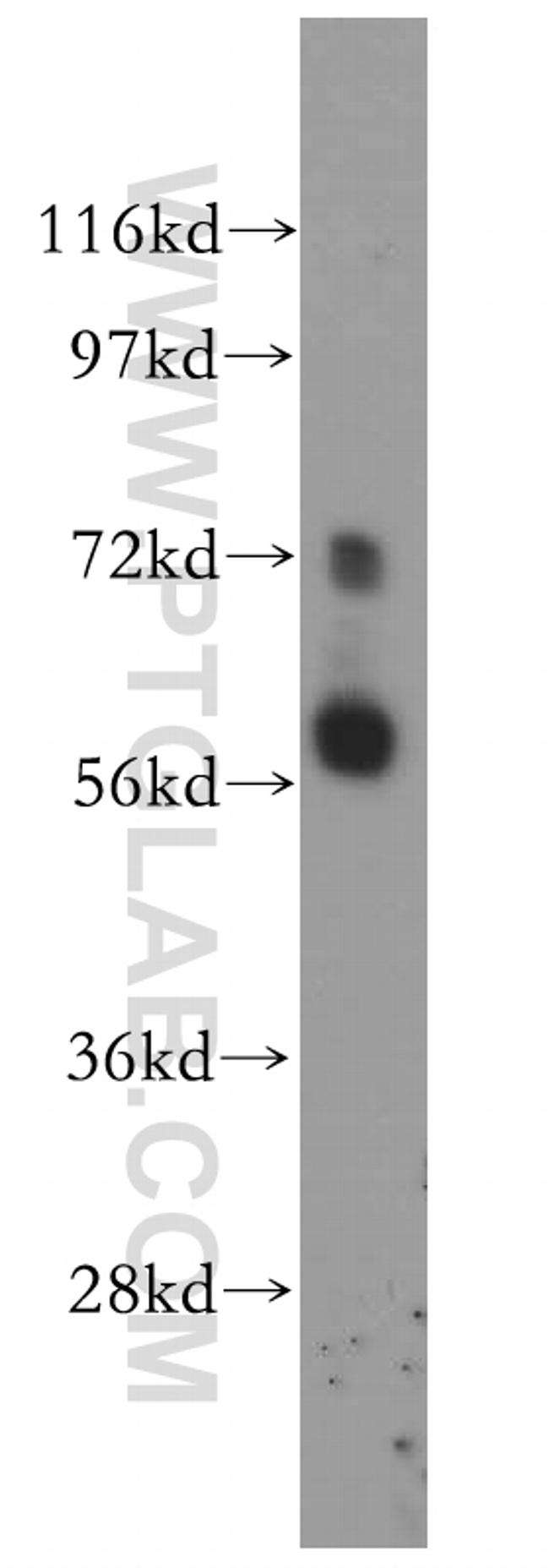 LRRTM1 Antibody in Western Blot (WB)