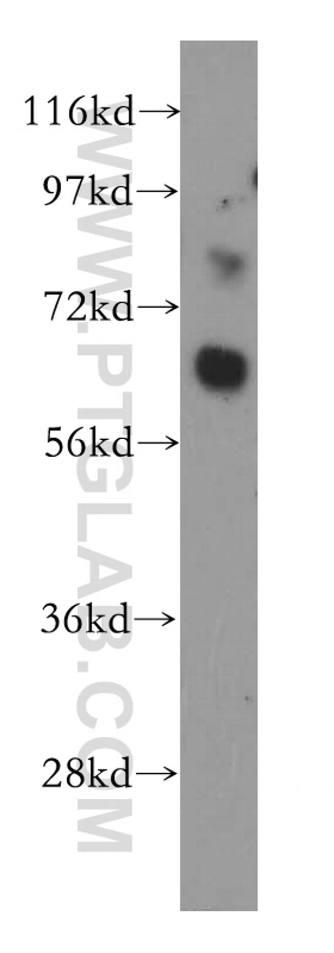 LRRTM1 Antibody in Western Blot (WB)