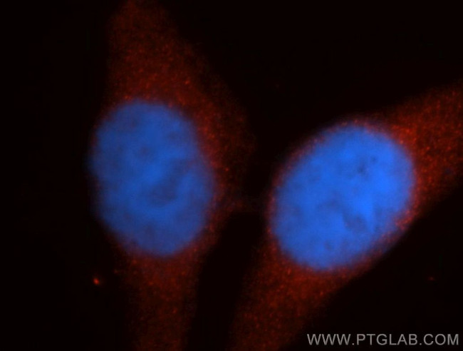 Renin Antibody in Immunocytochemistry (ICC/IF)