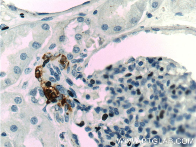 Renin Antibody in Immunohistochemistry (Paraffin) (IHC (P))