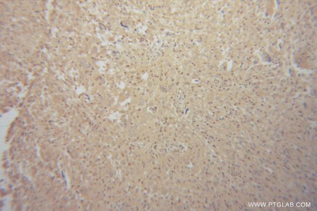 Renin Antibody in Immunohistochemistry (Paraffin) (IHC (P))