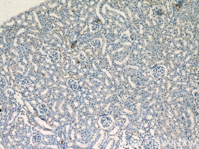 Renin Antibody in Immunohistochemistry (Paraffin) (IHC (P))