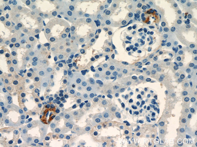 Renin Antibody in Immunohistochemistry (Paraffin) (IHC (P))