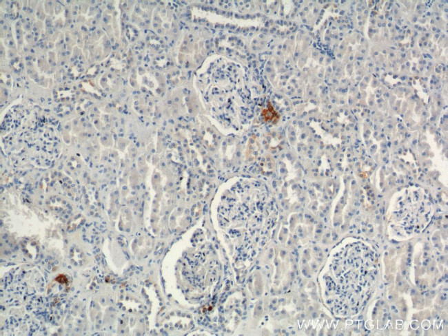 Renin Antibody in Immunohistochemistry (Paraffin) (IHC (P))