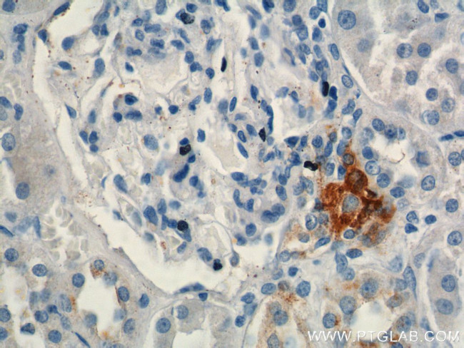 Renin Antibody in Immunohistochemistry (Paraffin) (IHC (P))