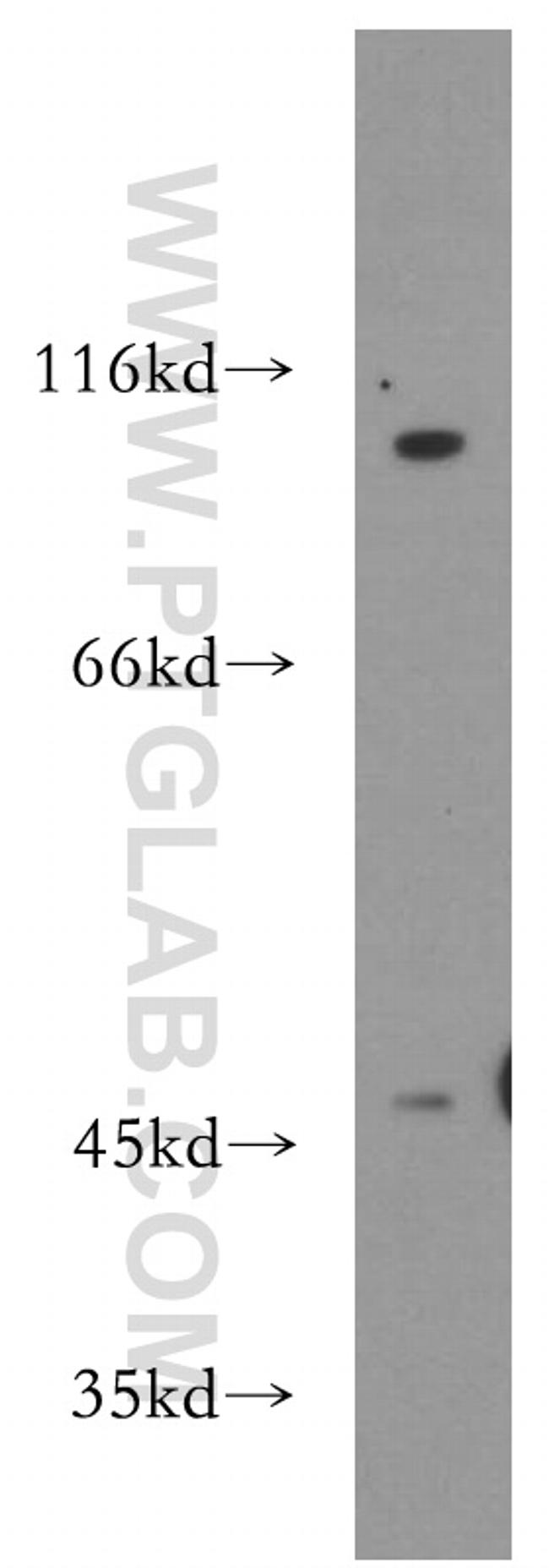 Renin Antibody in Western Blot (WB)