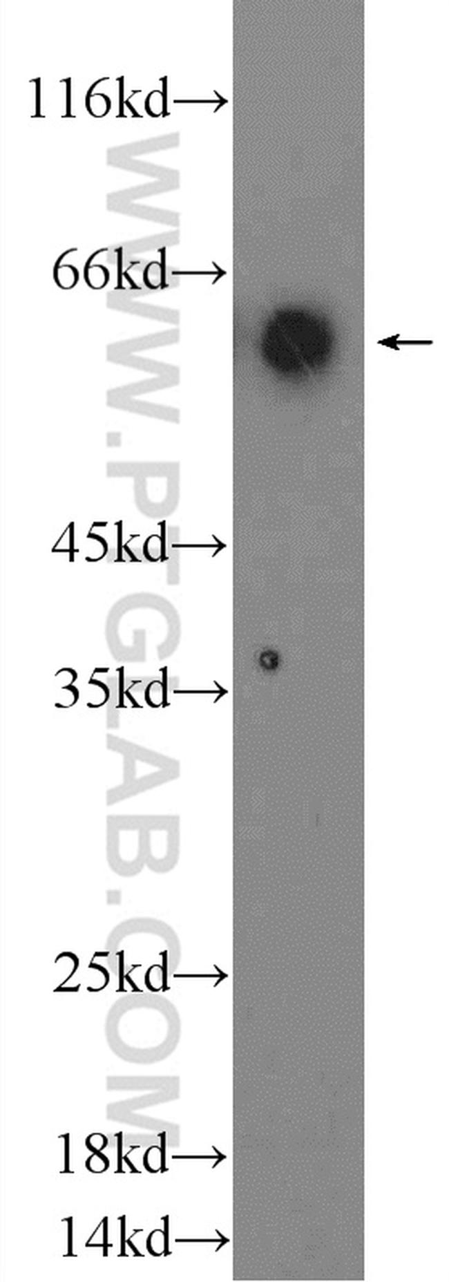 CD80/B7-1 Antibody in Western Blot (WB)